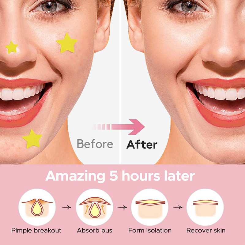 600 sztuk/zestaw Plasterki na  – Beauty And Makeup recenzja i cena